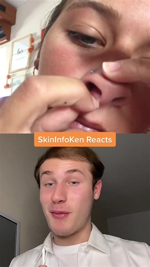 Nose vs Nail: Dealing with Nasal Folliculitis