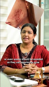 Makeup for Acne-Prone Skin: What You Need to Know #heliosclinic