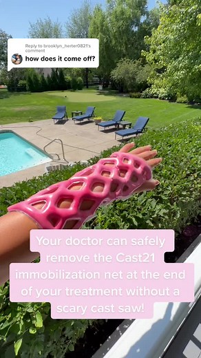 Safe and Easy Cast Removal with Cast21