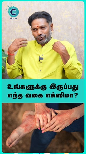 Thanga Tamil Murugan discusses the different types of Karapan (various skin conditions) and their Siddha remedies. #fblifestyle #cosmoreels #cosmohealth #thangatamilmurugan #siddha #karapan #skincare #eczema #psoriasis #tamilhealth #naturalremedy #holistichealth #traditionalmedicine #skinhealth #dermatology | Cosmo Health