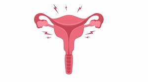 Animated uterus problems element. Flat cartoon style HD video footage. Woman reproductive health. Gynecology color illustration on white background with alpha channel transparency for animation