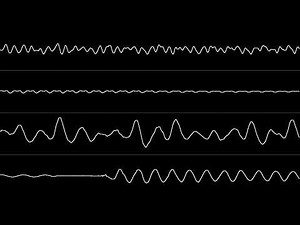 SNES Equinox: Tori - Oscilloscope View