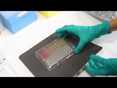 Conceptos básicos de la técnica ELISA. Protocolo del ELISA en Sandwich.