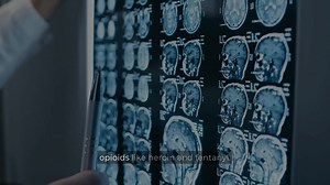 Are medications for opioid use disorder substituting one drug for another? Dr. Winhusen with @uc_health explains: “No, we are not just replacing one drug with another. Methadone and buprenorphine have very different pharmacology that helps to stabilize the brain and produce positive public health outcomes.” Watch the video explainer from #HEALingCommunities. | Addiction Policy Forum
