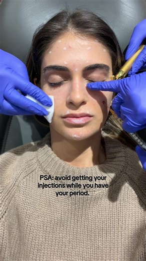 Why Getting Botox During Your Period Can Be Painful