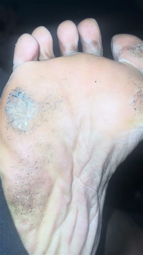 Sole scrunching and toe wiggling for your viewing pleasure. #feet #soles #toes