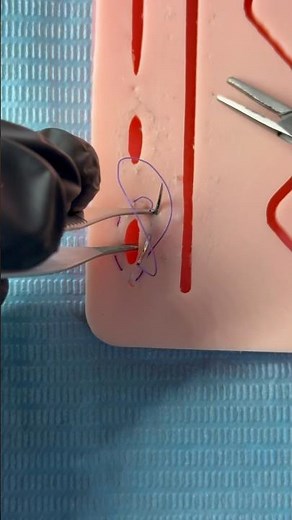 Purse string suture 👛 #shorts #viral #purse #suture #doctor