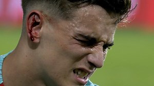 Gavi left with bleeding ear which needed stitches after Ruben Garcia clash