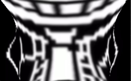 sans为了拥有大脑做了开颅手术，这是她现在的情况