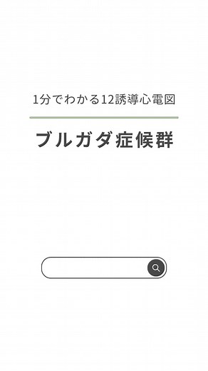 ブルガダ症候群を1分で解説！心電図のポイント