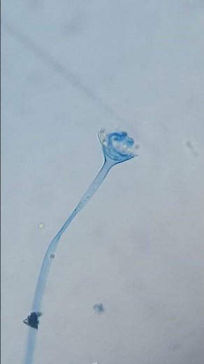 Mucor sporangium, spores, sporangiophore #science #shorts