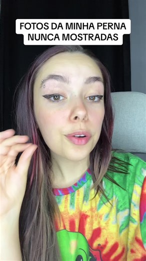 Antes e Depois: Fotos da Minha Perna Nunca Mostradas
