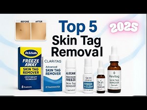 Best Skin Tag Removals of 2026 – Top 5 Reviewed!