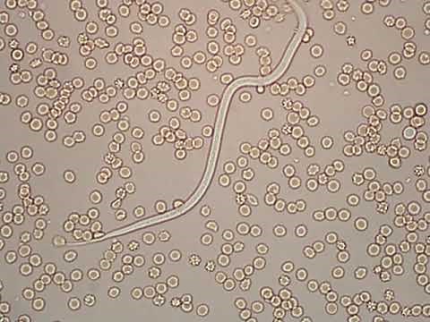 Dirofilaria immitis - microfilaria (400x)