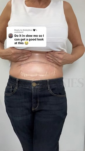 12 reactions | Here’s a close up of our Instant Tummy Tuck shapewear tape!  Let us know what you think!  LINK IN BIO to order  #tummycontrol #tummycontrolshaper #tummycontrolshapewear #tummyshaper #tummyshapewear #tummybodyshaper #shapewearfortummy #shaperfortummy #shapewear #bodyshaper | Skinnies Instant Lifts | Facebook