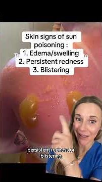 Dermatologist reacts to severe sunburn. How to tell if it’s sun poisoning. #sunburn #shorts