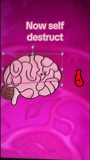 Apendicitis #animated #animation #appendicitis #appendix #meme #memes #storytime #brain