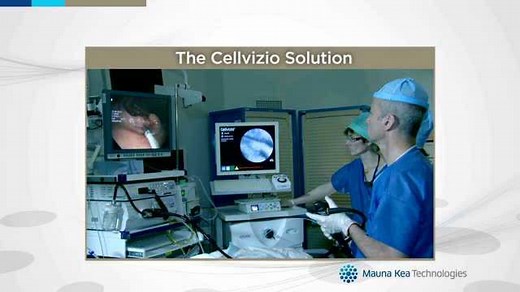 Cellvizio，全球唯一的探头式共聚焦激光显微内镜