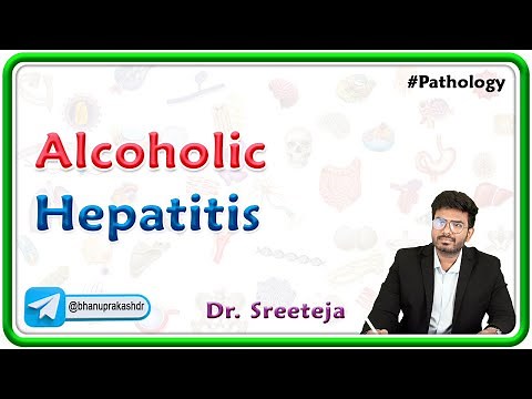 15. Alcoholic Hepatitis | USMLE Step 1 Pathology