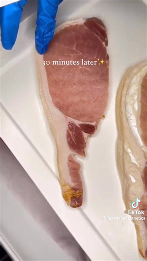 13K views · 38 reactions | This is how Lemon Bottle works! ✨Say goodbye to stubborn fat! whether it’s your double chin, tummy, arms, or face, Lemon Bottle helps melt it away safely and effectively!  | Earl Gado | Facebook