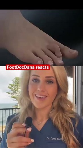 Toe surgery explained in 10 seconds