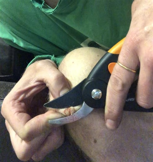 Cut off my wart. Will it grow back?