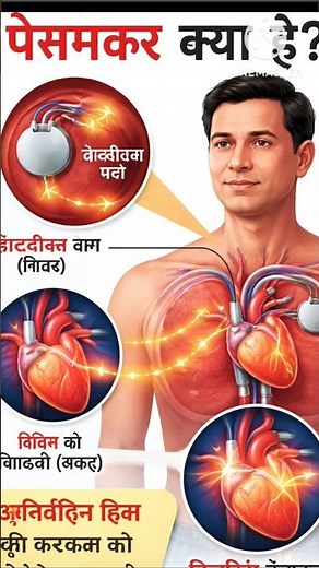 THIS TINY DEVICE CAN RESTART YOUR HEART 😨😨 | Pacemaker Explained #VIRAL SHORTS #EDUCATIONAL #SCIENCE