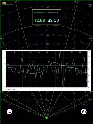 Vital Signs monitoring with mmWave Radar (1)