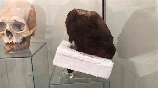 Paracas elongated skulls of Peru