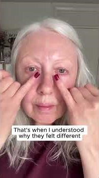 Micro Needling Patch for Under Eyes Thats Fixing The Most Stubborn Bags. Bye Bye Expensive Fillers!!
