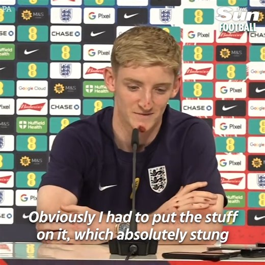 12K views · 29 reactions | "I've gone ten feet in the air - chin first!" 勞 Anthony Gordon opens up on his horror bike crash while on England duty.  | Sun Sport | Facebook