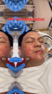 Introducing Vampire Facial 🩸🩸💉Platelete-Rich Plasma (PRP) The only treatment that uses your own blood for your beauty skin care, 100% safe and no rejection. 100% safe and natural Regular Price Php 2,999 per session Promo Price Php 2,999 for 2 session. 🔥Benefits of a Vampire Facial:Increased Collagen Production. Around the age of 25, your body's collagen production rate drops drastically.✔️ Reduced Fine Lines and Wrinkles.✔️ Tighter, Firmer Skin. ✔️ Improved Moisture Retention. ✔️ Enhanced Sk