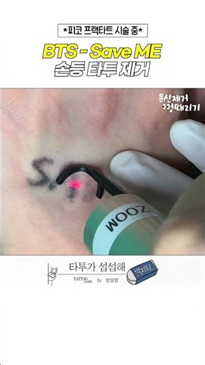 BTS - Save ME 손등 타투 제거