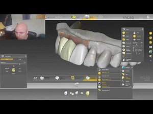Line Angles In CEREC/InLab