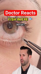 Doctor Reacts to Satisfying Eye “String” Removal 🥴 | Doctor ER