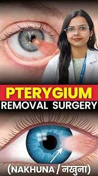 Red Eye Growth Removal Surgery | Pterygium Treatment