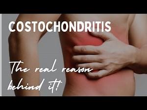 Costochondritis | The real reason behind it | Arogya physiotips #ribs