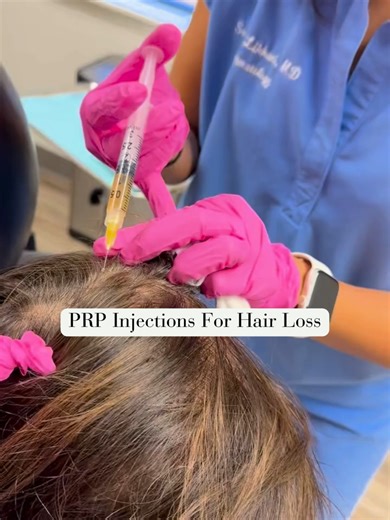 One of my favorite treatments for hair restoration? PRP injections. 💉✨ Hair thinning does not mean you’re out of options — let’s talk about it. PRP = Platelet-Rich Plasma Here’s what that means: 🔹 We draw a small sample of your blood 🔹 Spin it in a centrifuge 🔹 Extract the platelet-rich layer — packed with growth factors These growth factors help wake up dormant hair follicles, improving thickness and slowing shedding. Who is PRP good for? ✨ Early hair thinning ✨ Male or female pattern hair 