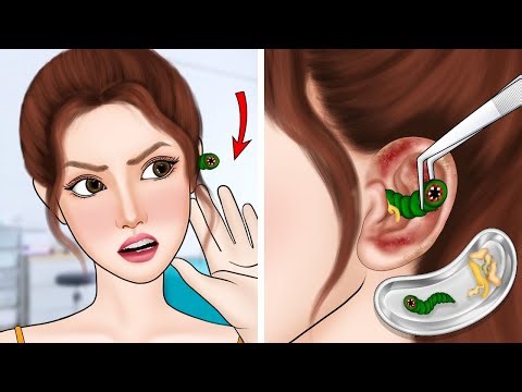 ASMR Remove the worm from the ear canal and clean out the earwax | Earwax Removal Animation