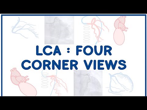 Left Coronary Artery Angiogram: The Four Corners Overview