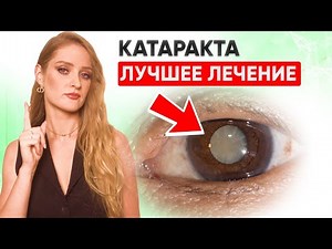 HOW TO STOP CATARACTS AND GLAUCOMA? Eye Exercises and Vitamins