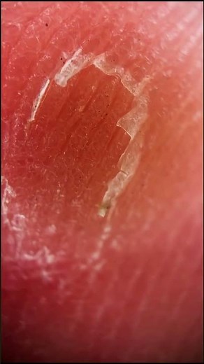 My palm! #microscopy #biology #shorts