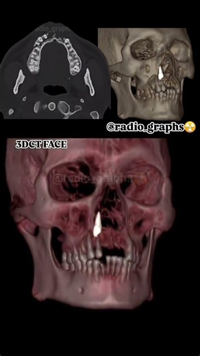 3dct face #mri #ctscan #xray #anatomy #doctor #viralvideo #nurse #science #radiographer #radiology