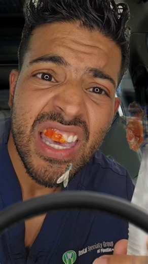 If your gums bleed… you have a problem 👀 #dentaltips #teethdecay