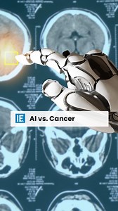 16K views · 119 reactions | AI breakthroughs are transforming cancer treatment and early detection, providing patients with improved, minimally invasive options. | Interesting Engineering | Facebook