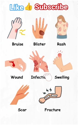 Common Skin Injuries You Should Know 🩹#medicalvocabulary#skincare#firstaid #education#subscribe🔔