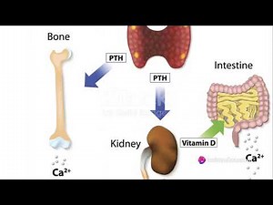 Unlocking The Enigma Of Pseudopseudohypoparathyroidism: Get To Know Pphp