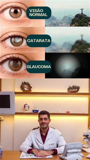 #catarata #glaucoma
