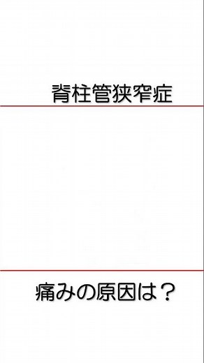 脊柱管狭窄症 痛みの真の原因は？ 手術が必要？ 【医師が解説】 #坐骨神経痛 #脊柱菅狭窄症 #椎間板ヘルニア
