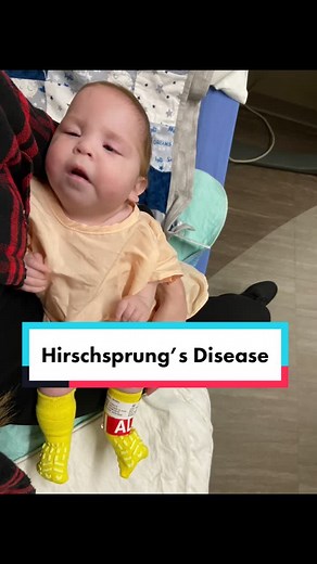 Understanding Hirschsprung’s Disease in Babies: Bentley's Journey